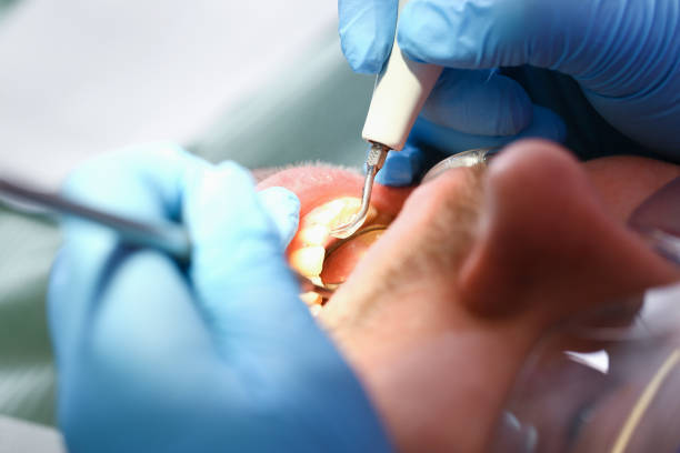 Best Emergency Treatment for Toothache in Niagara Falls, NY