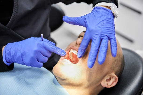 Best Emergency Broken Tooth Repair in Niagara Falls, NY